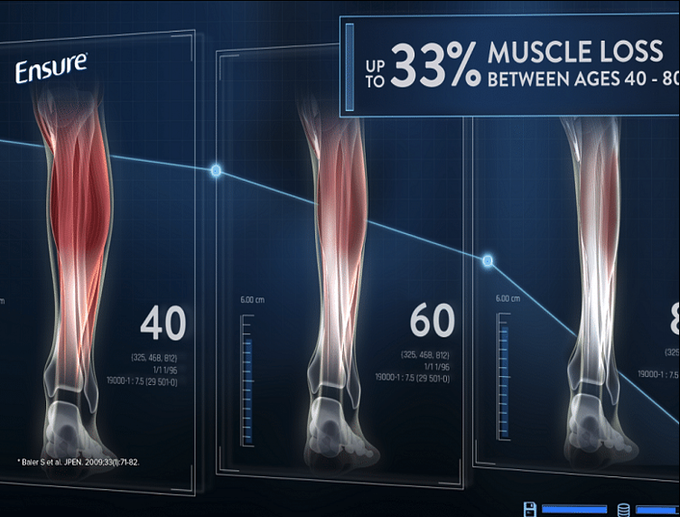 Figure 11: Age related muscle loss
