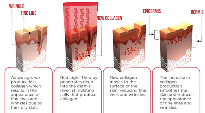 Figure 17: How Red Light Therapy works