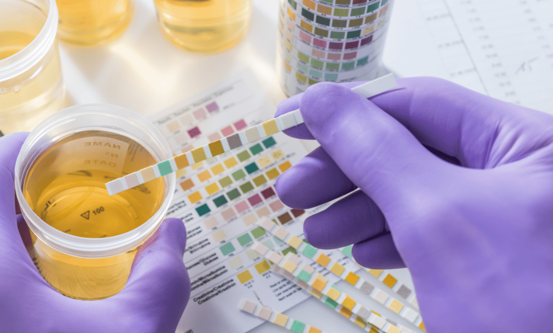 detecting glyphosate in urine a simplified test